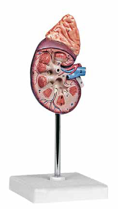 Kidney with Adrenal Gland, 1.5 Times Enlarged, 2 parts